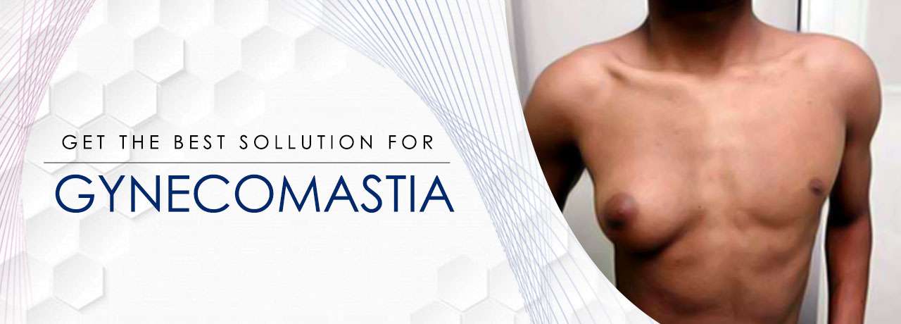 Gynecomastia surgery in kolkata