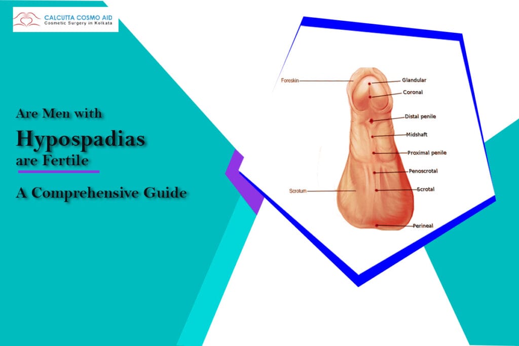 Men with hypospadias are fertile