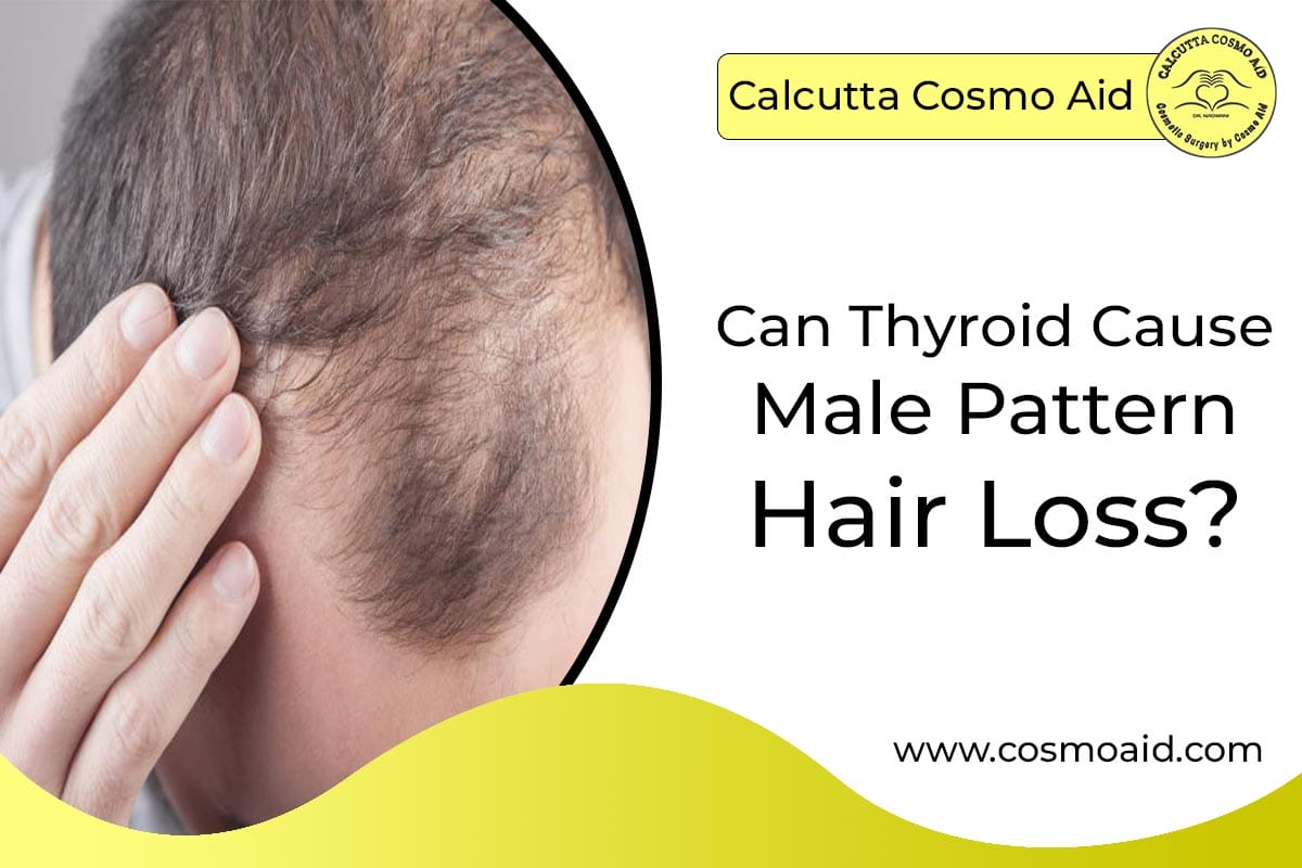 Can Thyroid Cause Male Pattern Hair Loss Cosmo aid