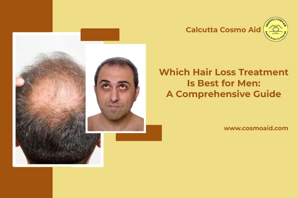 Which Hair Loss Treatment Is Best for Men