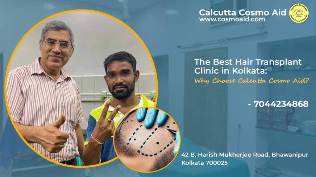 best hair transplant clinic in kolkata