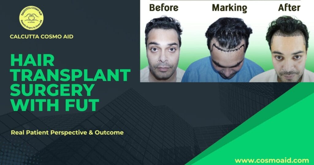 Hair transplant surgery