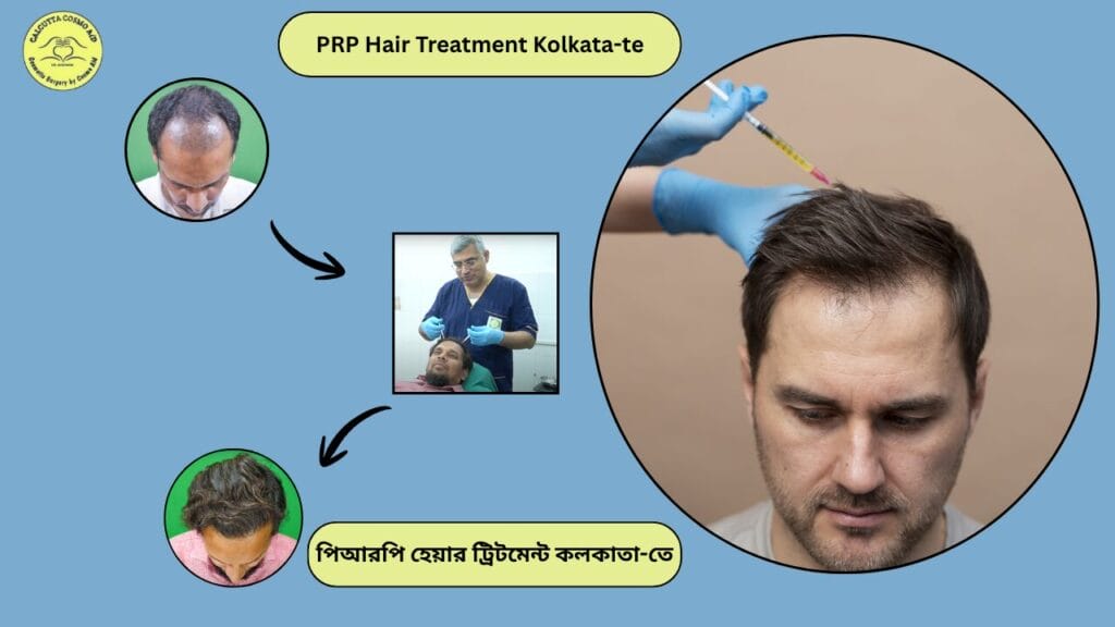 Prp hair treatment Kolkata te